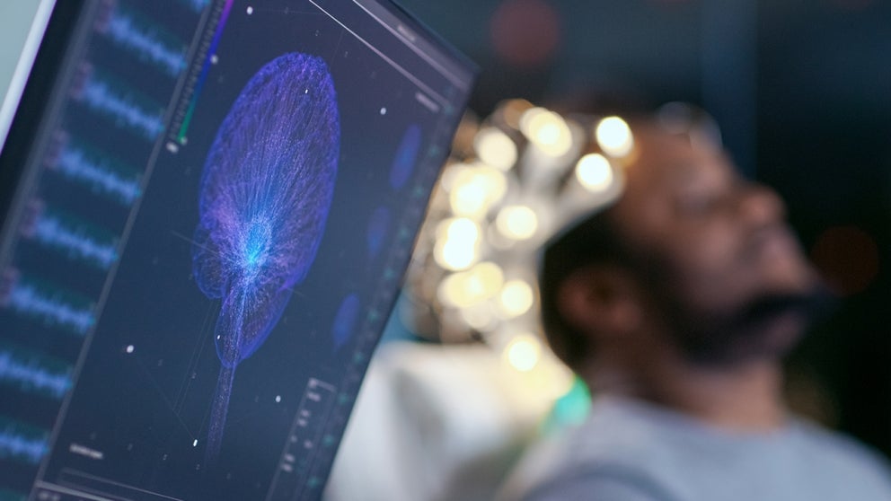 Brain on monitor with patient in background